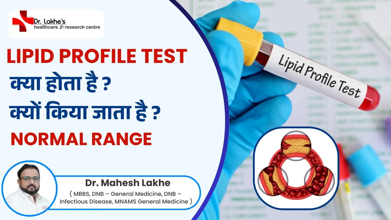 Home Lipid Profile Test